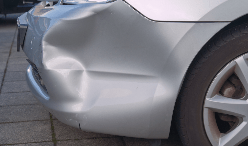 DENT REMOVAL